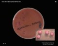 klebsiella pneumoniae mucous colonies on MacConkey